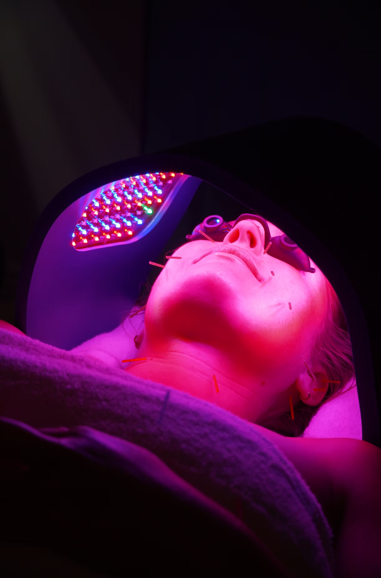 Cosmetic facial acupuncture and microneedling skincare services at Point Acupuncture in Portland, Maine